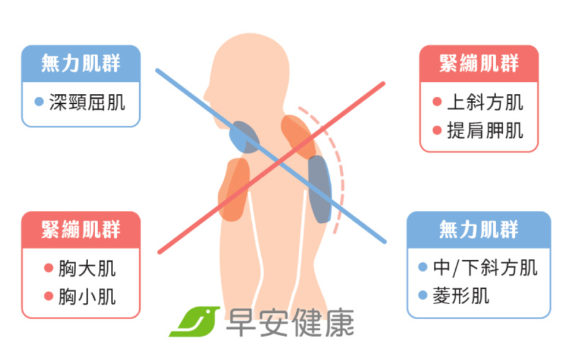 本頁圖片/檔案 - 上交叉症候群