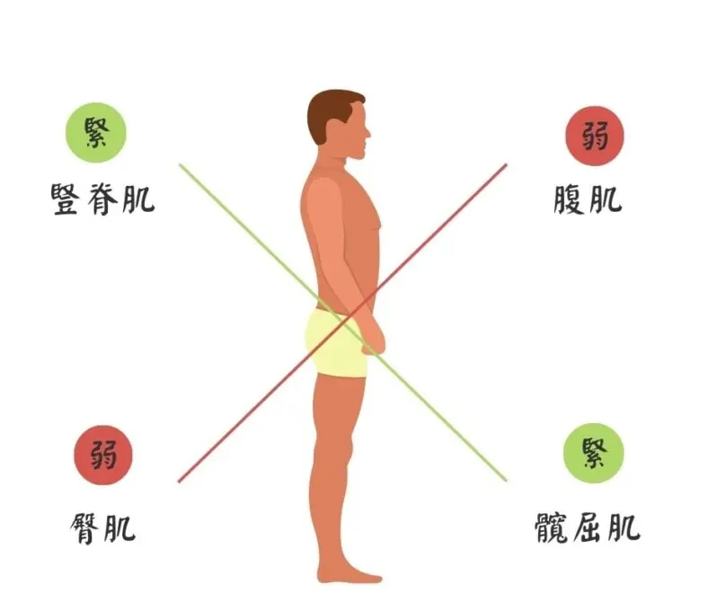 本頁圖片/檔案 - 下交叉綜合症